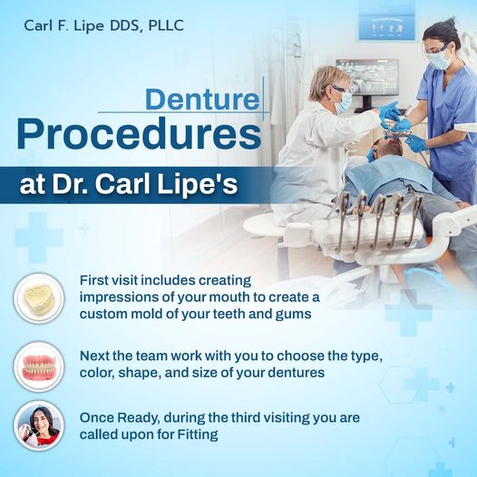 Denture Procedure at carl lipe