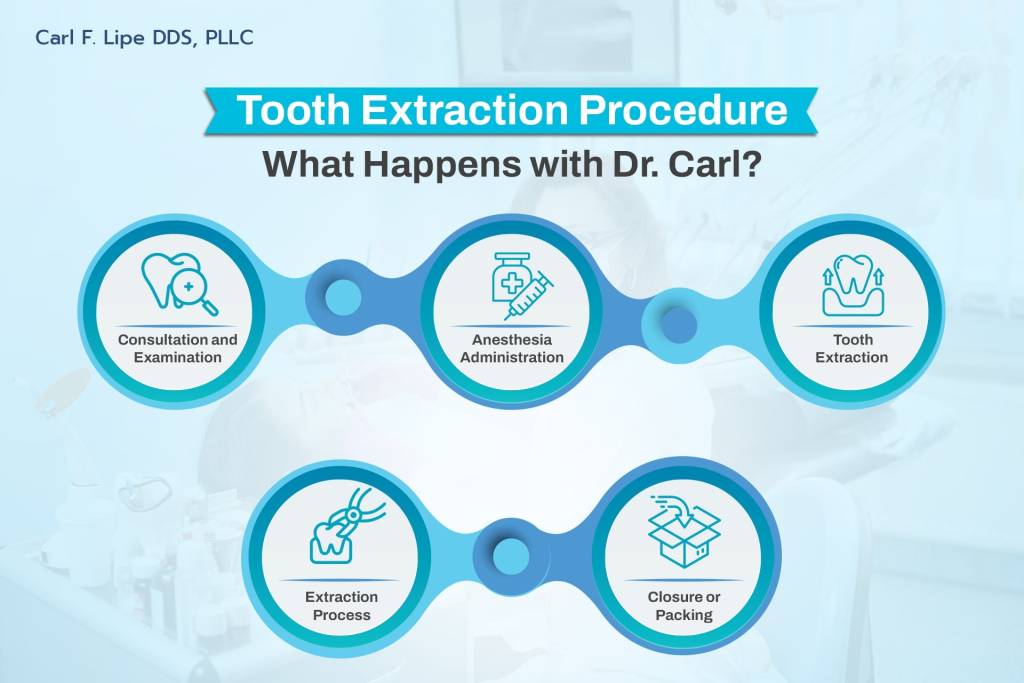 Tooth Extraction Procedure