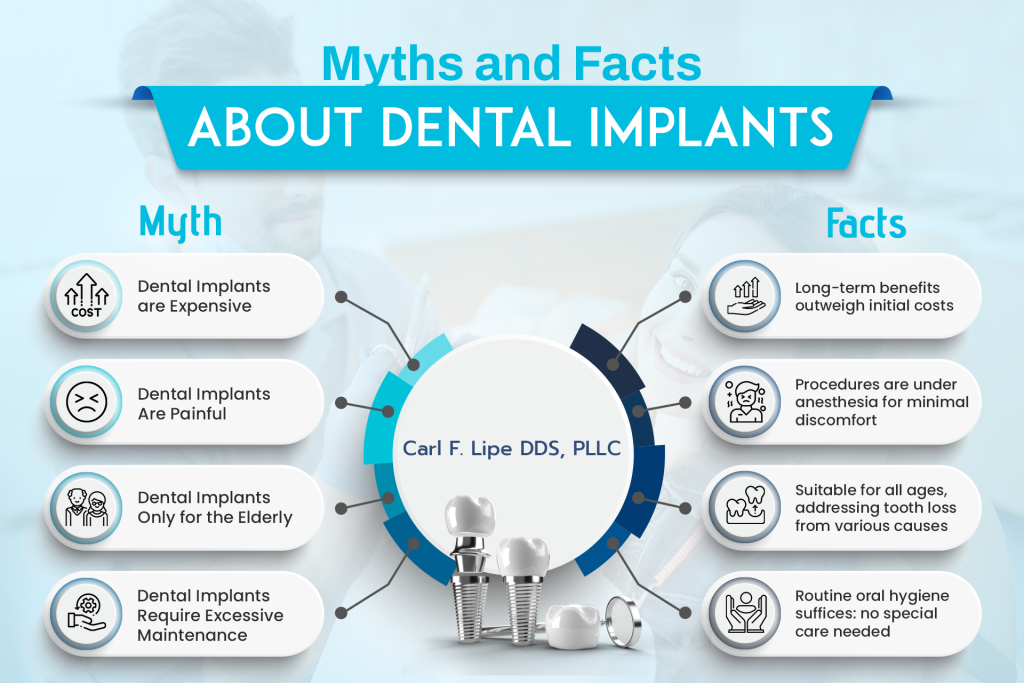 myths and facts about dental implant procedure