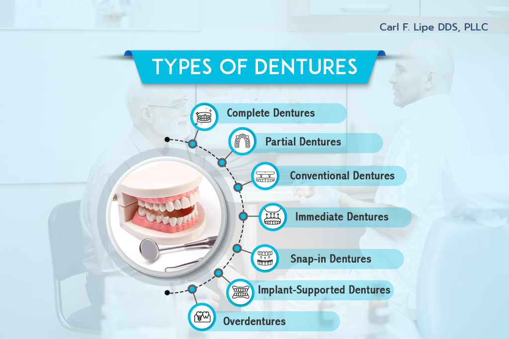 Types of Dentures