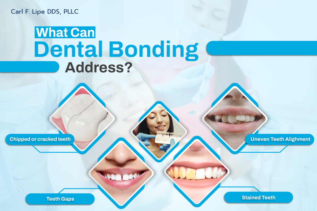 What does cosmetic dental bonding do?
