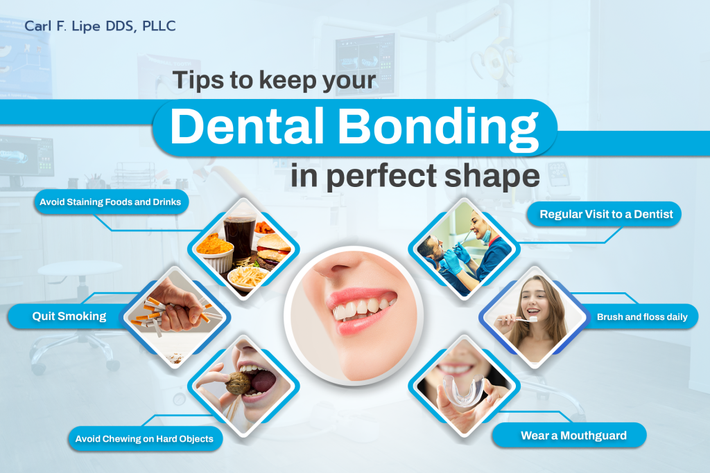 Tips To Keep Your Dental Bonding In Good Condition