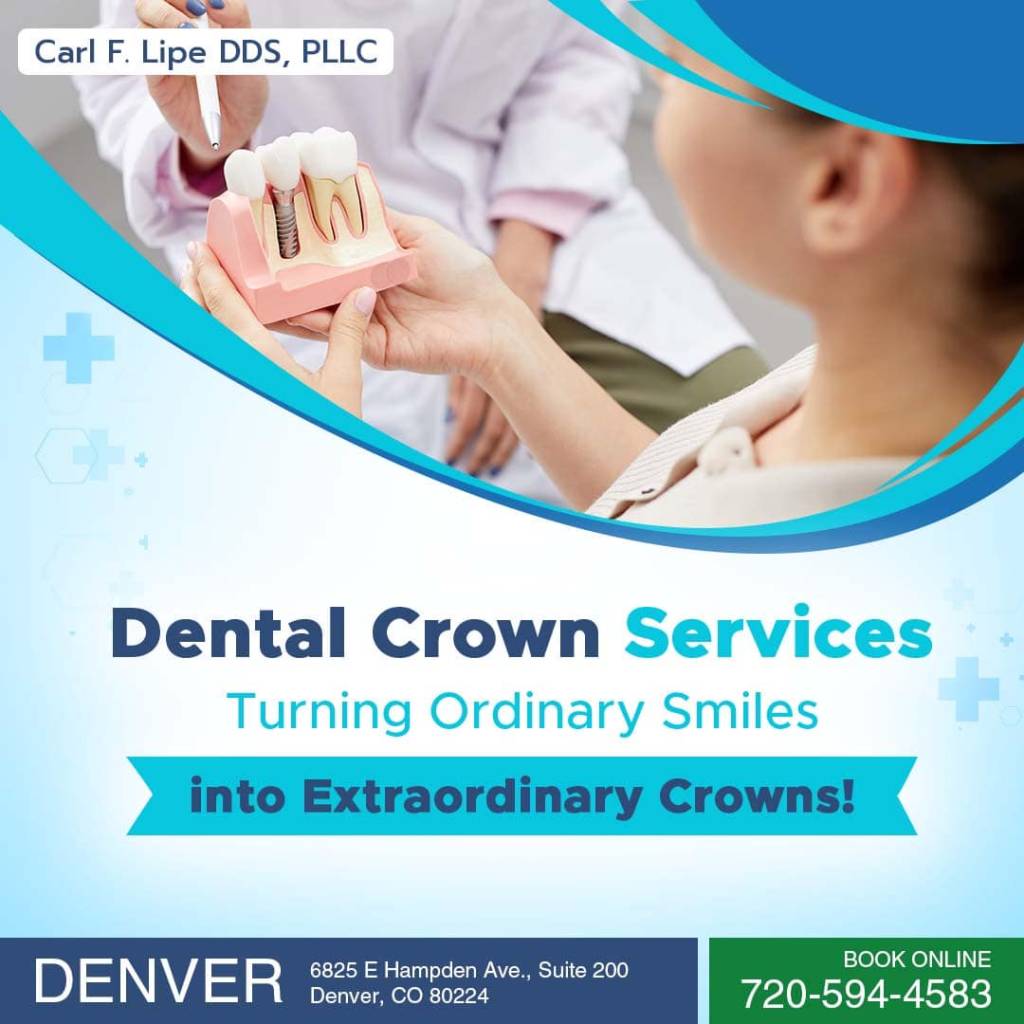 dental crown service in denver