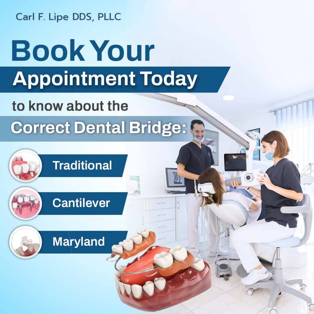 Dental Bridges in Denver