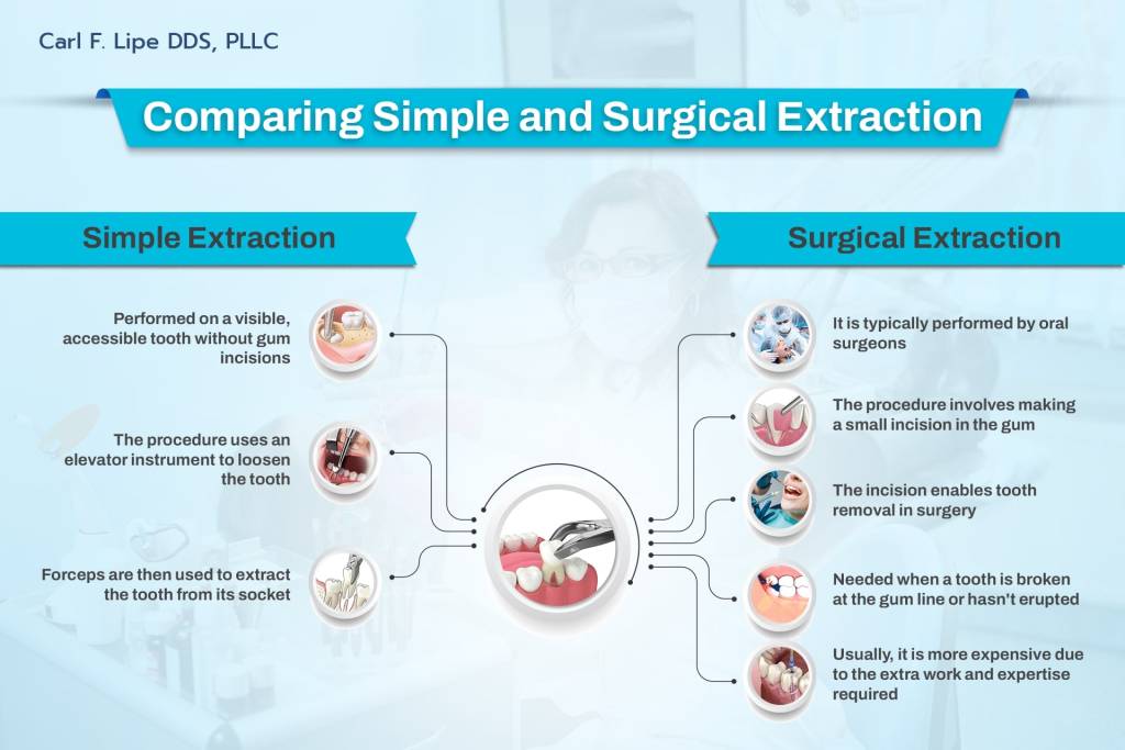 simple vs surgical tooth extraction