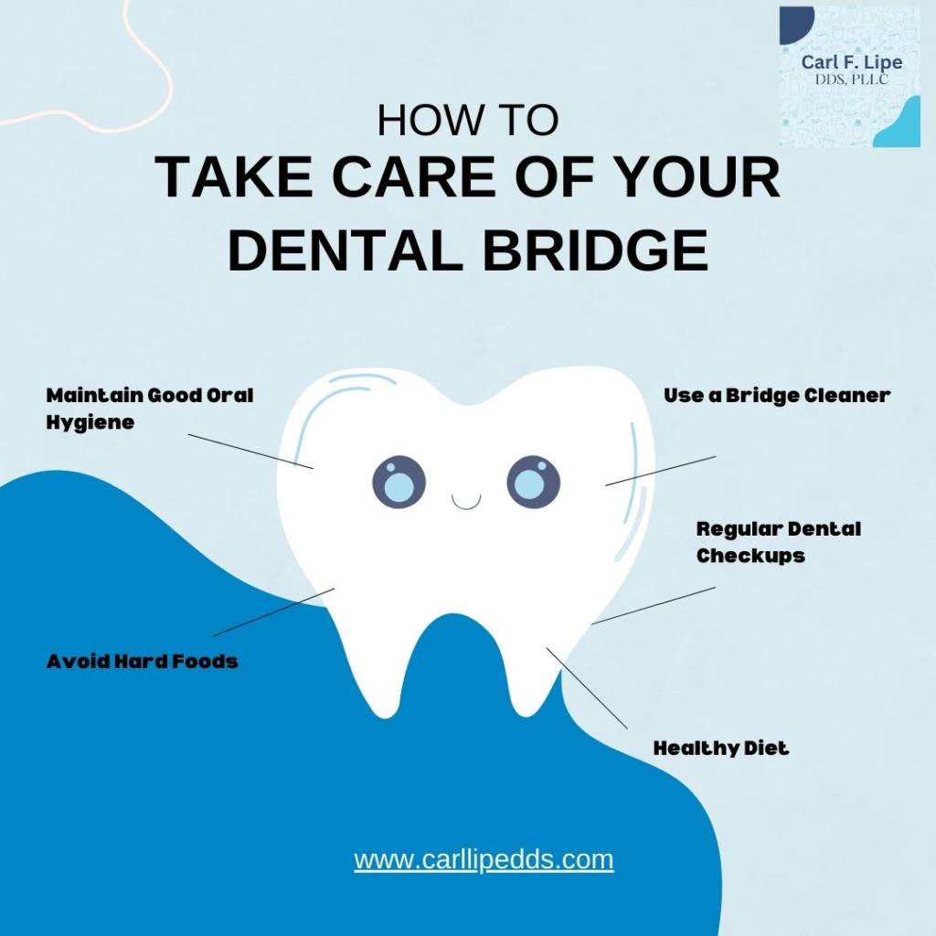 how to take care if your dental bridge?