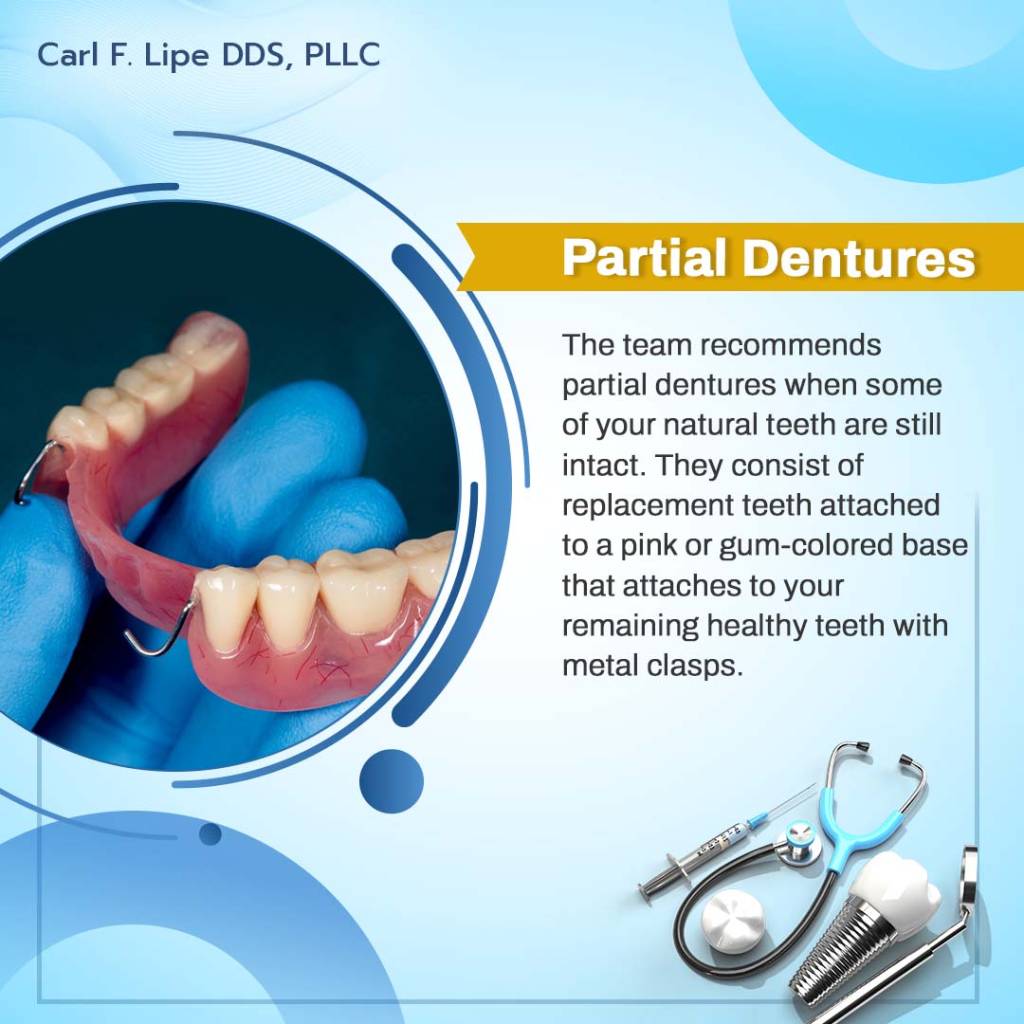 what are partial dentures?