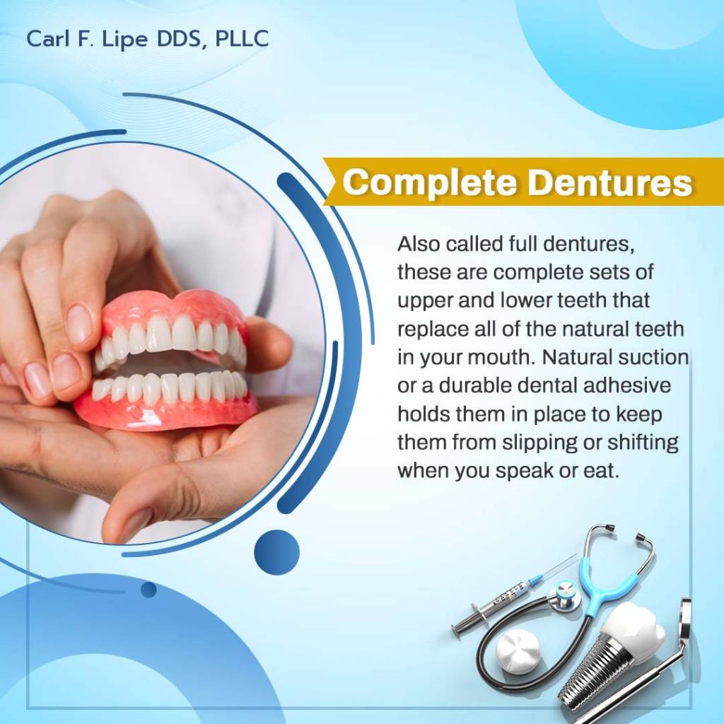 what are complete dentures?