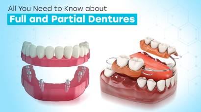 All You Need to Know about Full and Partial Dentures