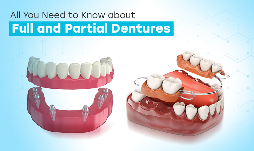 All You Need to Know about Full and Partial Dentures