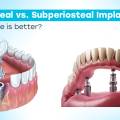 Endosteal vs Subperiosteal Implants: Which one is better?