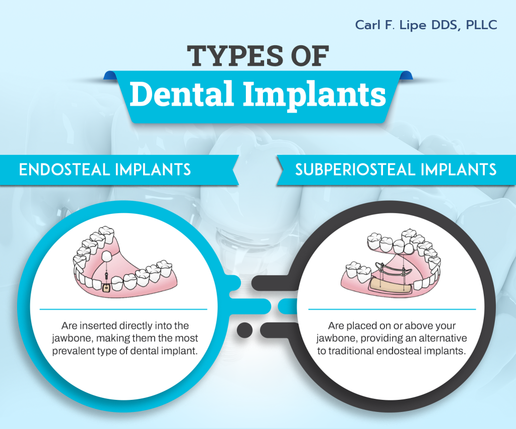 types of dental implant