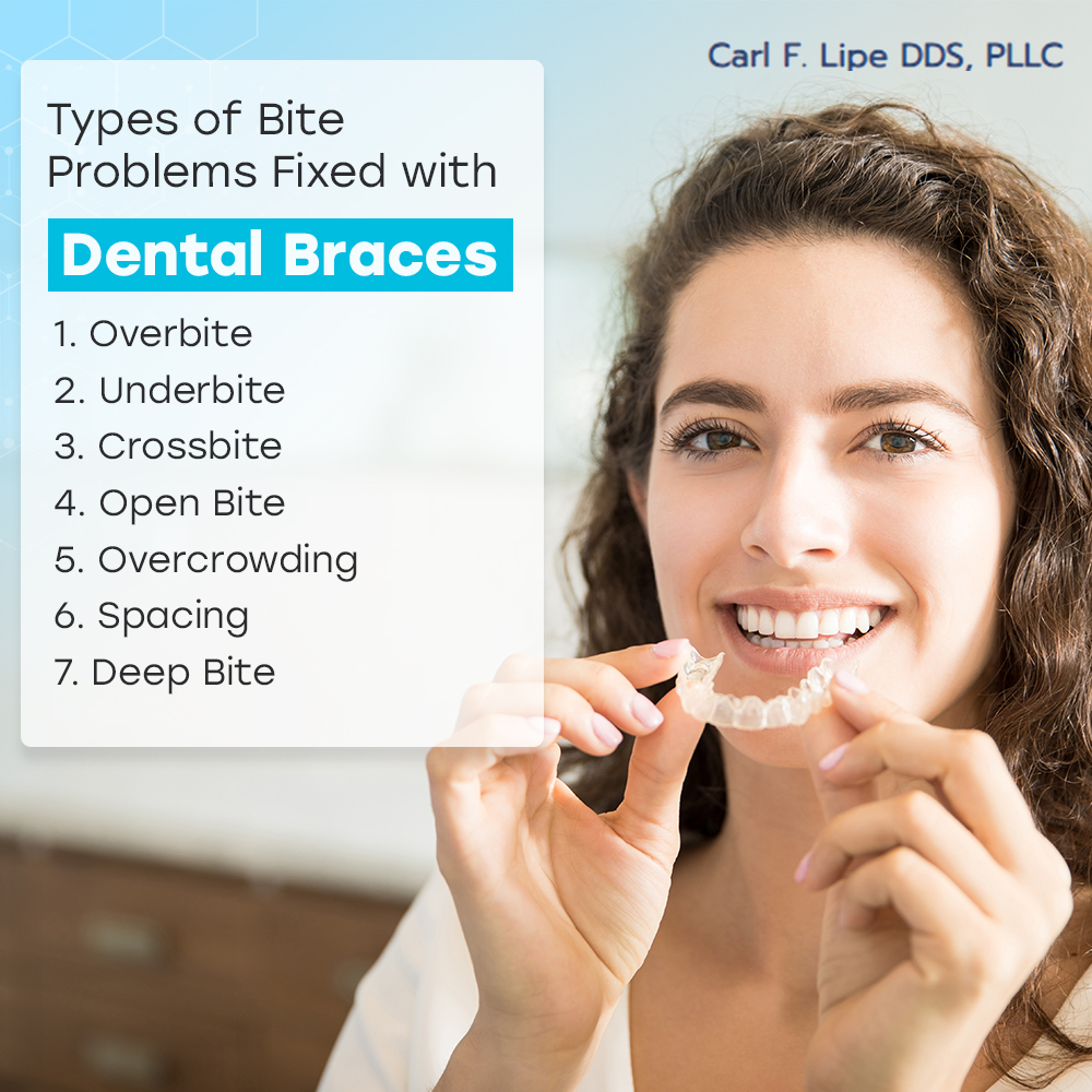 Bite Problems Fixed with Dental Braces