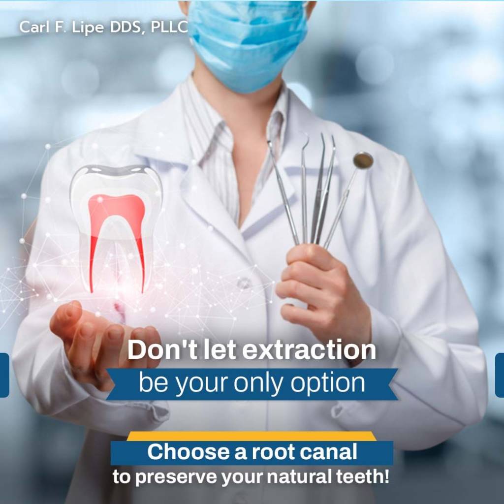 Tooth extraction vs root canal